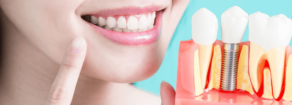 Восстановление жевательных зубов